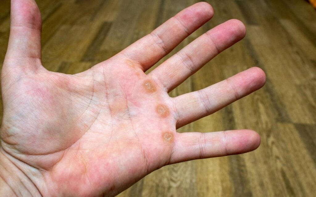 Close up of a hand with calluses